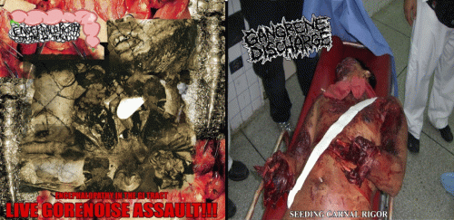 Gangrene Discharge : Gangrene Discharge - Encephalopathy in the Gi Tract